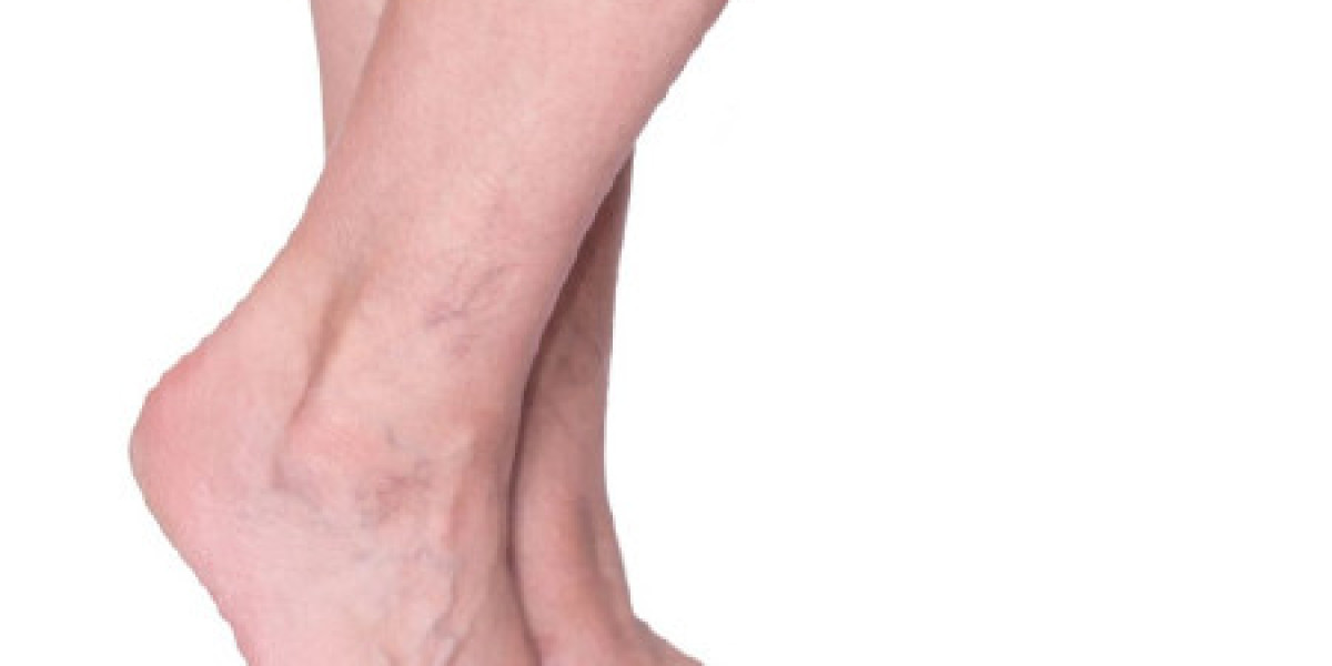 Lotus Laser Skin Rejuvenation – The Best Laser Hair Removal Clinic in Sherwood Park