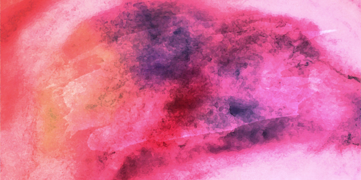 Gold IRA Rollover: A Strategic Approach to Wealth Preservation