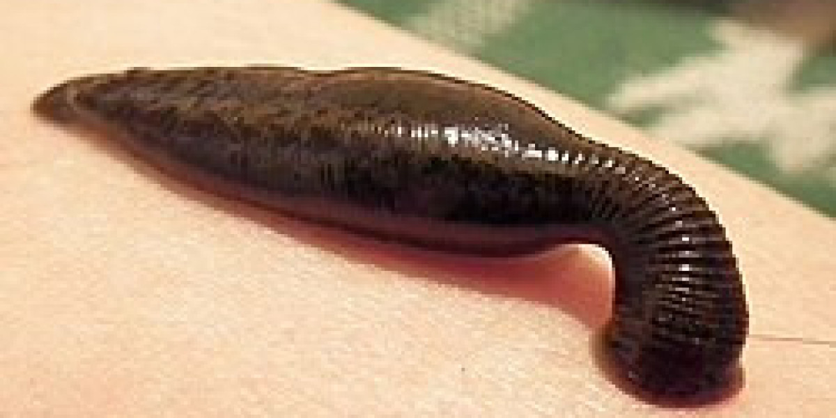 How to Find the Best Leech Treatment in Mumbai for Safe Healing