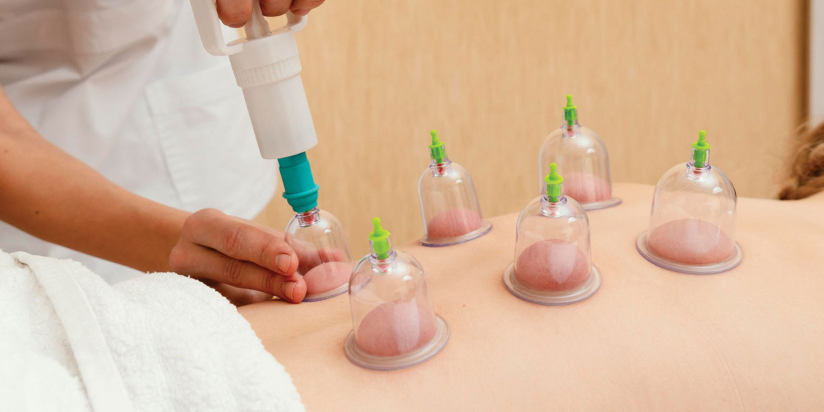 How Cupping Therapy for Hair Regrowth Improves Scalp Circulation